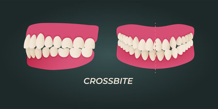 Realistic vector illustration of teeth and gums on dark background.