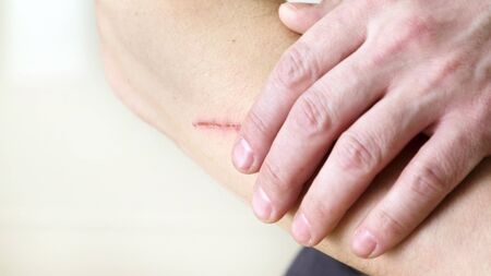 Man touches a scratch on his hand. Close up.の写真素材