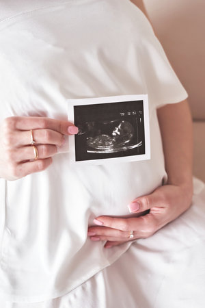Ultrasound scan of pregnancy. Expecting a baby. Pregnancy and parenthood.の写真素材