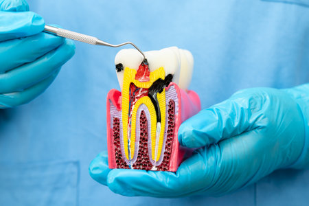 Dentist use dental instrument to check artificial tooth roots dental implant into jaw, Root canal model.の写真素材