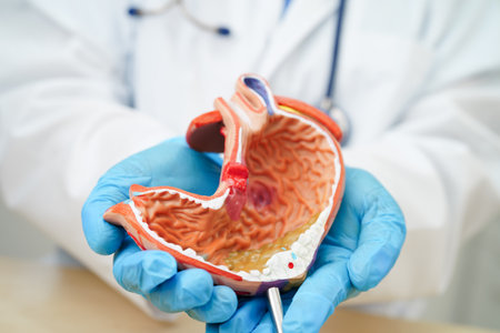 Stomach disease, doctor holding anatomy model for study diagnosis and treatment in hospital.の写真素材