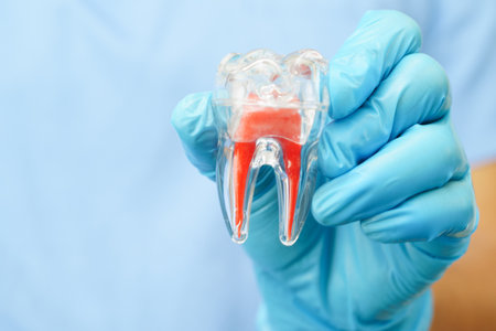 Dental implant, artificial tooth roots into jaw, root canal of dental treatment, gum disease, teeth model for dentist studying about dentistry.の写真素材