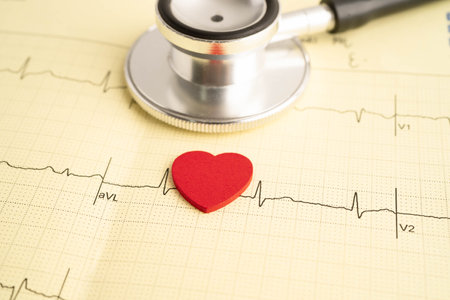 Stethoscope on electrocardiogram ECG, heart wave, heart attack, cardiogram report.の写真素材
