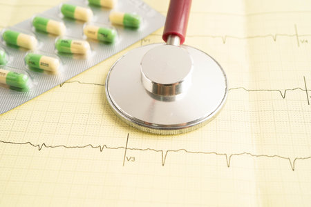 Stethoscope on electrocardiogram ECG, heart wave, heart attack, cardiogram report.の写真素材