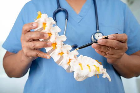 Asian doctor holding spinal nerve and bone model, Lumbar spine displaced herniated disc fragment for treatment medical in the orthopedic department.の写真素材