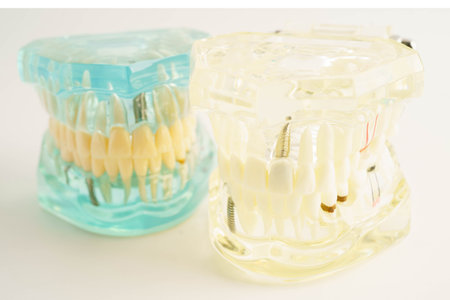 Dental teeth model on white background for learn about dentistry.
