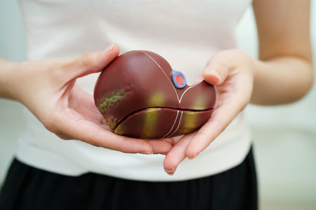 Cirrhosis, Liver cancer, fatty liver, Asian woman with liver human anatomy model.の写真素材