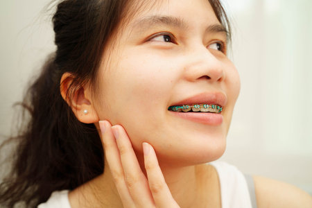 Asian woman with dental braces orthodontic treatment dental care.の写真素材