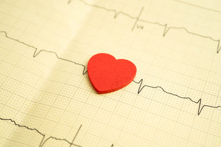Electrocardiogram ECG, heart wave, heart attack, cardiogram report.