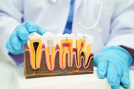 Dentist holding dental implant, artificial tooth roots into jaw, root canal of dental treatment, gum...