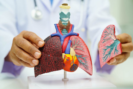 Pneumonia, lung cancer, Asian doctor holding human anatomy model for study diagnosis and treatment in hospital.の写真素材