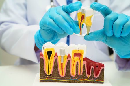 Dentist holding dental implant, artificial tooth roots into jaw, root canal of dental treatment, gum disease, teeth model for dentist.の写真素材