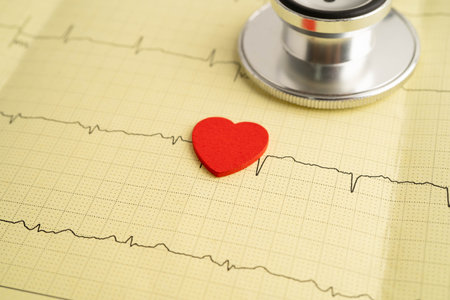 Stethoscope on electrocardiogram ECG, heart wave, heart attack, cardiogram report.