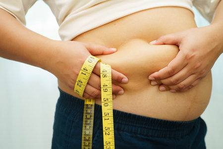 Asian woman with fat belly big size overweight and obesity with measure tape.
