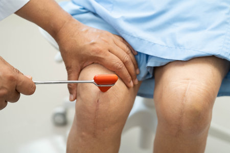 Doctor neurologist testing reflex knee with hammer and show Asian senior scars surgical total knee...