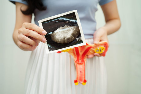 Uterus ultrasound, Asian woman holding human anatomy model.