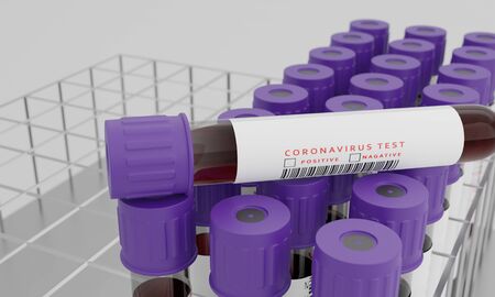Test tubes with blood and coronavirus test label  isolated on white background. Concept for testing corona virus. 3D Rendering.の写真素材
