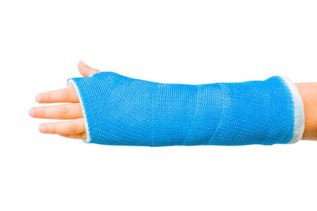 Cast of Childâs Broken Arm Isolated on White Backgroundの写真素材