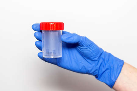 Doctor hand with bottle or jar or container for sperm or urine analysis.