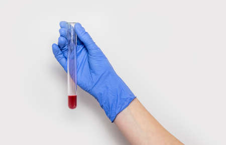 Blood sample in test tube for analysis in doctor hands close up isolated over white background.の写真素材