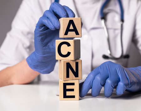 Acne word, inscription on paper in doctor hands, medical dermatology problem with skinの写真素材