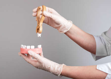 Dentist hands pulling tooth with forceps out of jaw model. Teeth removal, dentistry concept. Dental diseases treatment. High quality photoの素材 [FY310186297583]