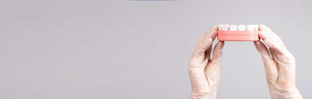 Banner with hands in gloves holding jaw model with teeth. Stomatology, dental care, oral hygiene...