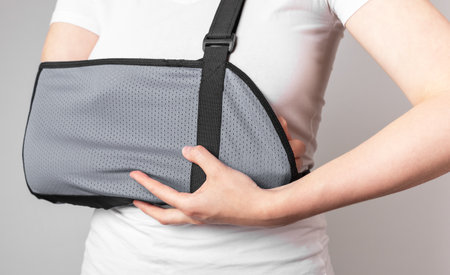 Woman wearing sling to protect painful forearm, wrist. Arm trauma, sprain, injury. Health care concept. Using medical devices for pain reduction. High quality photoの写真素材