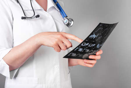 Doctor studying CT or MRI scan results. Diagnostics conducting for detecting diseases or injuries. Health care, medicine concept. Checking for medical problems. High quality photoの写真素材