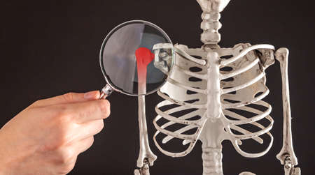 Hand with magnifying glass over humerus of human skeleton model. Shoulder overuse, strain,...