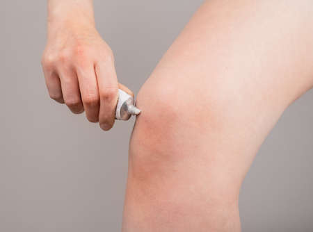 Woman putting pain relieving cream on knee. Leg injury concept. Bruise, sprain, arthritis healing. Health problems, medical conditions. High quality photoの写真素材