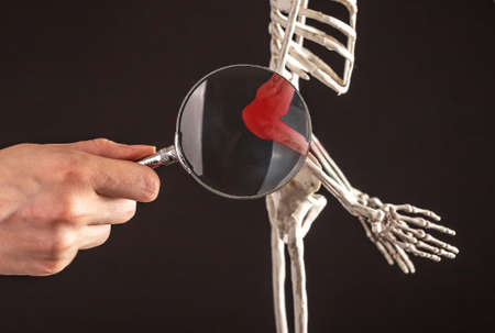 Hand with magnifying glass over elbow bones of human skeleton with red point. Humerus, radius, ulna. Arm pain caused by overuse, injury, chronic diseases. High quality photoの写真素材