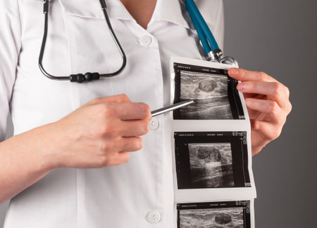 Breast scan, ultrasound result with fibroadenoma, disease. High quality photo