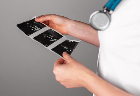 Heart ultrasound, cardiac scan, checkup result studying, holding in doctor hand. High quality photoの写真素材