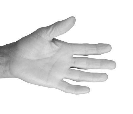 Closeup of elderly woman's hands showing both back and front views, fingers spread, wrinkled skin...