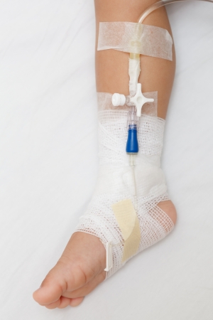 Leg of injured baby with bandageのeditorial素材