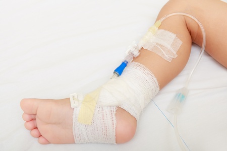 Leg of injured baby with bandageのeditorial素材