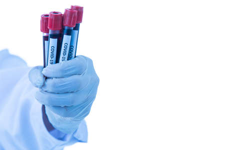 Hand of doctor in gown coat with stethoscope holding  sample test tubes of Covid-19. Idea for...