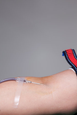 Arm of blood donator with needle and rubber tube in blood donation activity.の写真素材
