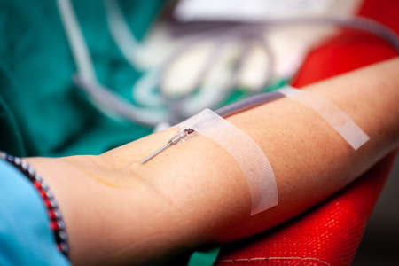 Needle stab in blood donation arm.の写真素材