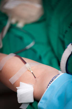 Needle stab in blood donation arm.の写真素材
