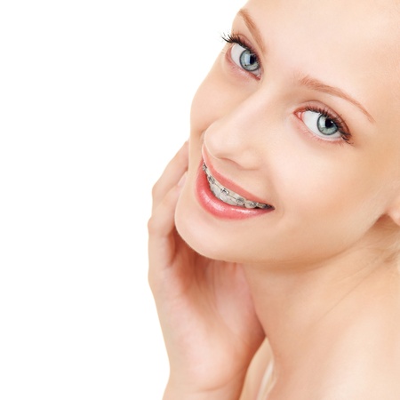 Cute girl in braces on white backgroundの写真素材