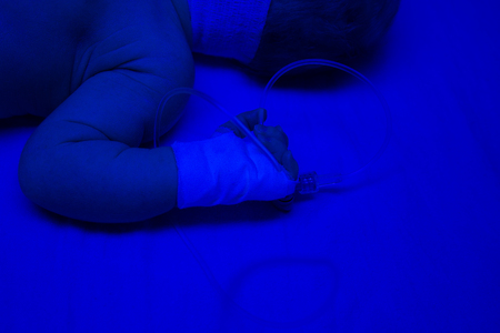 Newborn under the ultraviolet lamp. Child baby having a treatment for jaundice.の写真素材