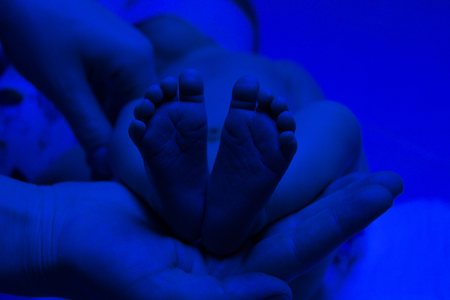 Mom holds legs in the palms of her hands. Newborn child baby having a treatment for jaundice under ultraviolet light in incubator.の写真素材