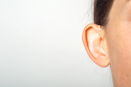 Female ear, lop-eared, protruding, close-up on a light background. Auricle defectの写真素材