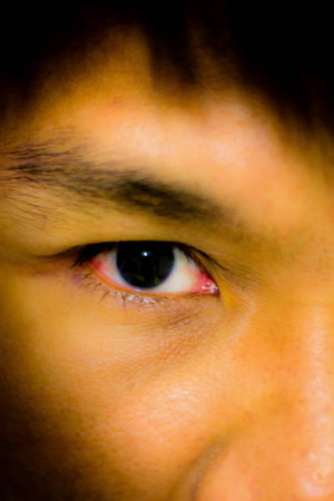 Eyes