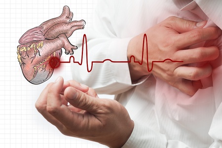 Heart Attack and heart beats cardiogram backgroundの写真素材
