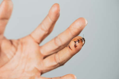 Close up of man hand with sutured wound on finger. Injured, Helth and medical Concept.の写真素材