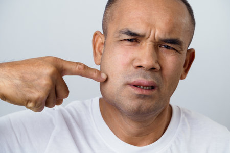 The man has facial swelling due to an allergic reaction to triggers such as insect bites stings, food, or medication. Close up of a swollen face.の写真素材
