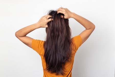 Women itching scalp itchy his hair and was massage her hair on a white background,Haircare conceptの写真素材